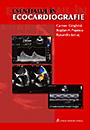 Esentialul in ecocardiografie